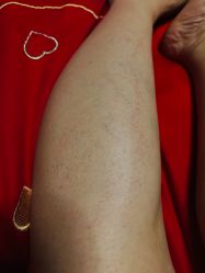 -上海玫瑰医疗美容医院