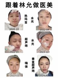 -MLP美丽派·问题肌疗愈中心