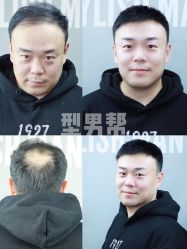 -型男帮男士假发补发·佩戴式发型
