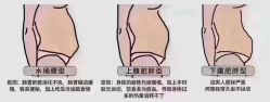 -丽减美瘦吧·减肥瘦身