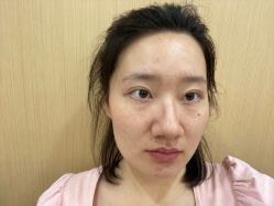 体验前-南京康美美容医院·旗舰店