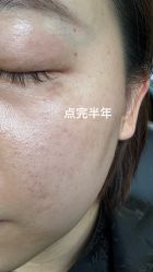 -小忠丽格医美