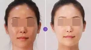 -SKINIST丽铂医疗美容