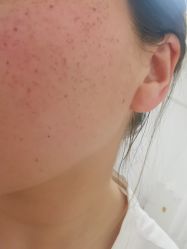 体验后-武汉颜范薇美医疗美容门诊部