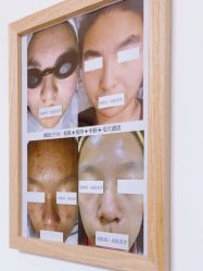 -美肤盾祛痘·问题肌头疗管理中心