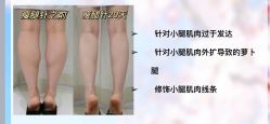 -YESIDO椰岛美容
