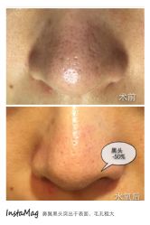 脸部抗衰-光SPA科技美肤