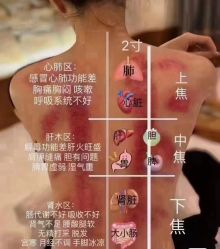 -香薇妮丝女子减肥院