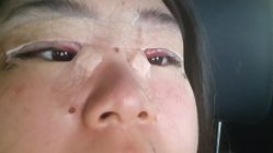 体验后-Dr.U博士医疗美容医院