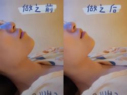 体验前-叶美人医疗美容