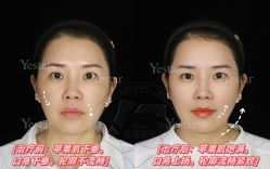 -Yestar艺星医疗美容医院