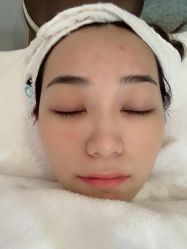 -痘院长·祛痘·皮肤管理