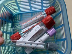 -悦检(中山大学孙逸仙纪念医院体检中心)