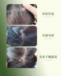 点击看大图 -舒欣头疗·俏丝谧语 白发脱发专业护理