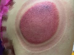 -沈师傅盲人按摩工作室(密三小区店)