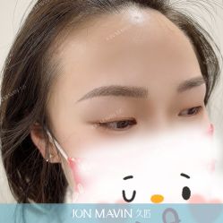 点击看大图 -久匠·纹眉纹绣半永久
