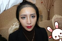 点击看大图 -大麦微针植发丨全国连锁