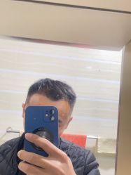 体验后-大麦微针植发全国连锁