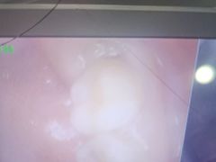 -土豆口腔(凤凰北总店)