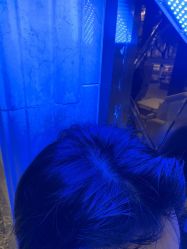 -碧莲盛·不剃发植发