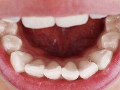 -Dr.Z dental仁康种植矫正中心