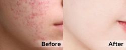 -SKINIST丽铂医疗美容