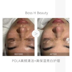 -Boss H Beauty美肌中心