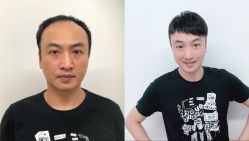 -发饰美男士增发补发假发定制店