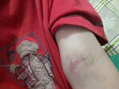 -广州市红十字会医院(总院)