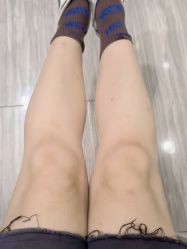 体验后-深圳阳光医疗美容医院·旗舰店