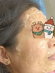 体验前-青岛诺德医学美容医院