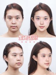 -星港国际·Skin皮肤专研·皮肤管理