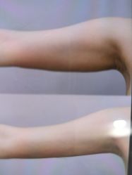 -郡艺医疗美容·微整·眼鼻吸脂