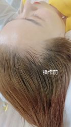 -MISS STAR·半永久纹眉·发际线·美瞳线