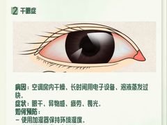 -黑马眼科·近视手术