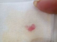 -复旦大学附属肿瘤医院(徐汇院区)