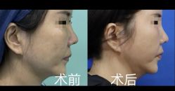 -上海华美医疗美容医院