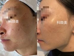 -美肤盾祛痘·问题肌头疗管理中心