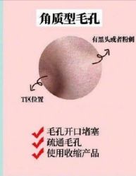 -凡碧诗毛孔清洁收细