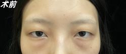 -素美医疗美容·西南眼鼻整形·修复基地