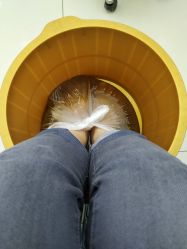 -派恩宜灰指甲鸡眼嵌甲手足癣