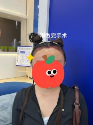 -大麦微针植发全国连锁