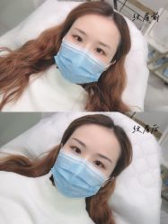 -久匠半永久纹眉