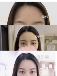 -久匠半永久纹眉