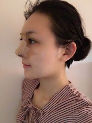 -洁铭新加坡医美
