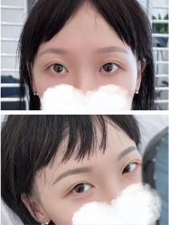 点击看大图 -张小野·专业半永久纹眉
