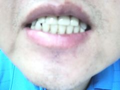 -Dr.Z dental仁康种植矫正中心