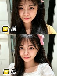 -广州健丽·去眼袋医疗美容机构