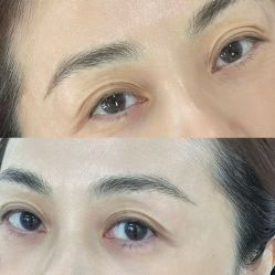 点击看大图 -张小野·专业半永久纹眉