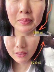 -兰派国际美容养生SPA